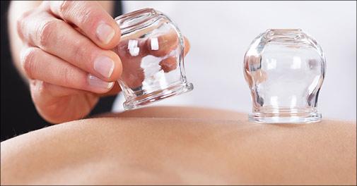 60 minutters Cupping behandling inkl. samtale