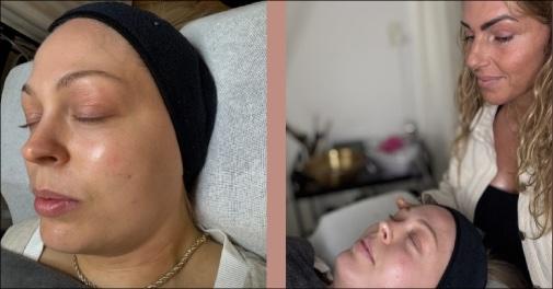 Få smuk glød og fornyet hud med diamantslibning og oxygenlift