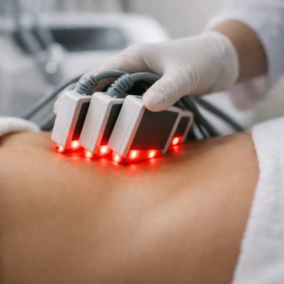 Fedtreducering  med laserlipobehandling