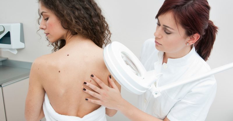 Skin Tag Removal for 1-4 Growths at Clear Skin by Tara