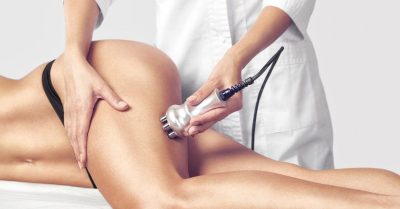 Transform Your Body with Laser Lipo at Sculpture Medi Spa