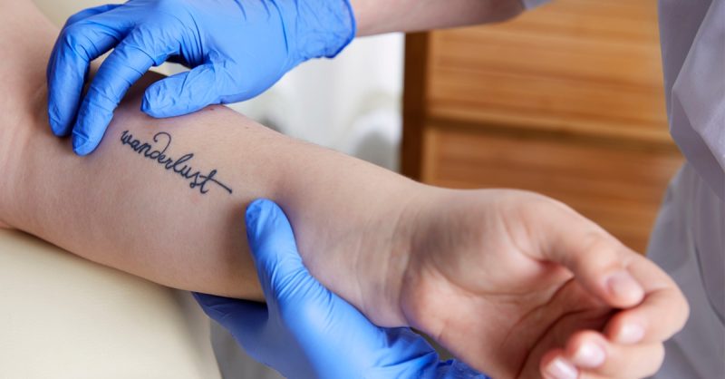 Laser Tattoo Removal or Eyebrow PMU Sessions at Agatha K Micropigmentation