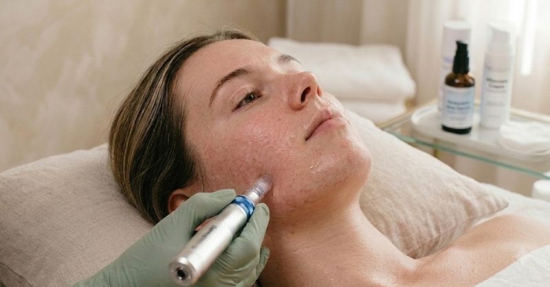 Micro-Needling Sessions at VitaFacials Spa for Radiant Skin