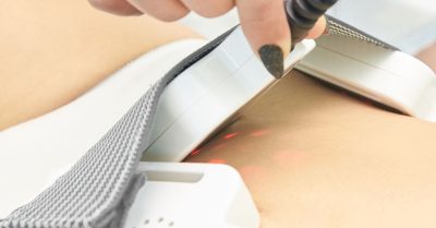 Non-Branded Fat and Cellulite Reduction at London Body Centre