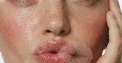Refined Contours with Doctor-Led Dermal Fillers at Maison De Skin