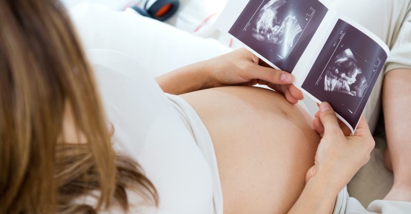 Premium 4D Fetal Scan at Window to the Womb (Southampton)