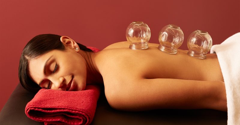 Cupping Therapy at Natures Way Chinese Herbal Medicine
