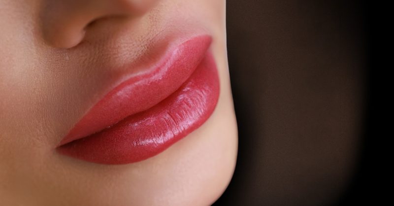 Dermal Filler Treatment at Aesthetics by Coco