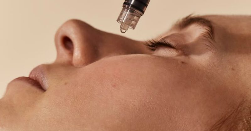 Effective Treatments for Wrinkles at Laser Care Skin Clinic