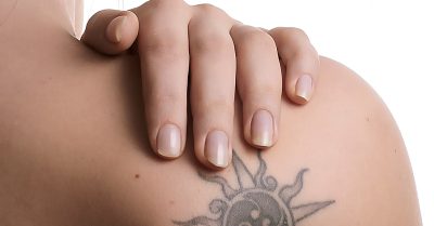Tattoo Removal at Sure Thing Studio (Formerly Demzines Laser Clinic)