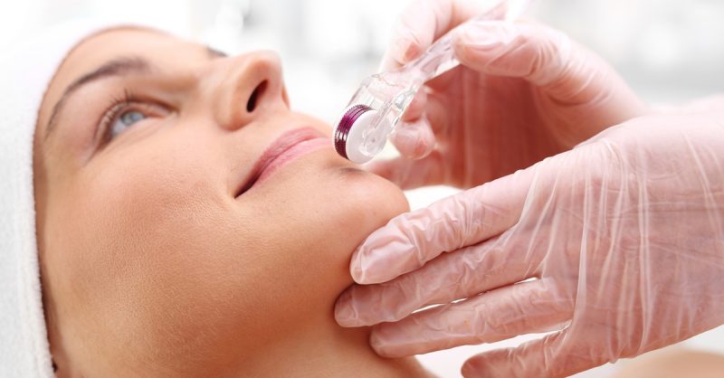 Microneedling Sessions at T Aesthetic Treatments