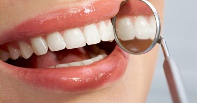 Teeth Whitening at Smile Studio Ashford for a Radiant Smile