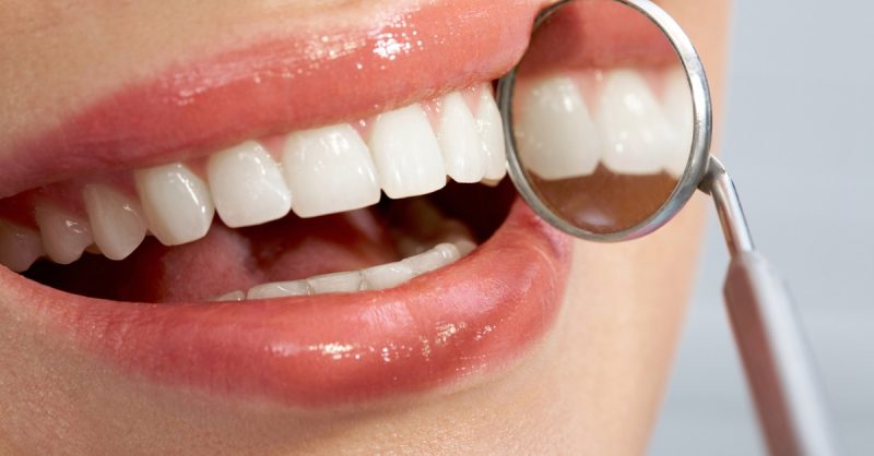 Teeth Whitening at Smile Studio Ashford for a Radiant Smile