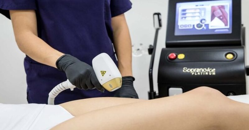 Platinum Laser Hair Removal at Mí Laser And Aesthetics