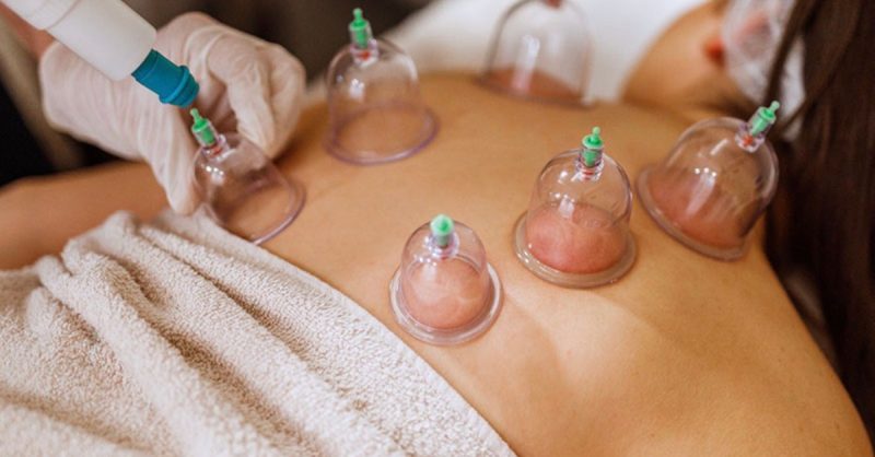 Hijama Cupping with 10-Minute Targeted Massage at Leveyna