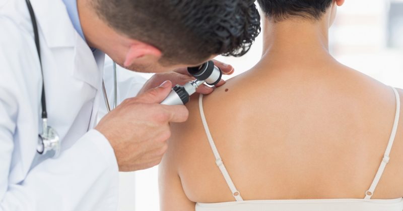 Mole, Skin Tag or Wart Removal Sessions at MPM Aesthetic Medicals