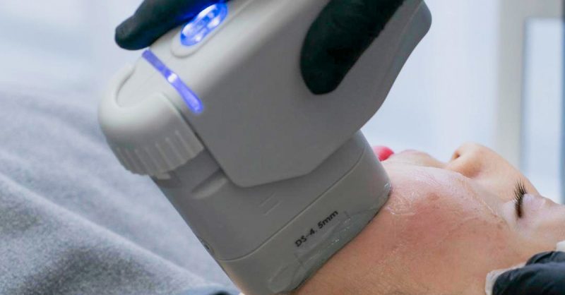 Double Chin Reduction Treatment at Pure Esthetics