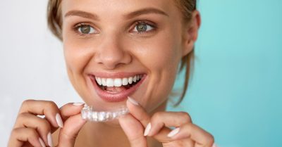 Home Teeth Whitening Kit with Custom Trays at Brighten Up Dental Clinic