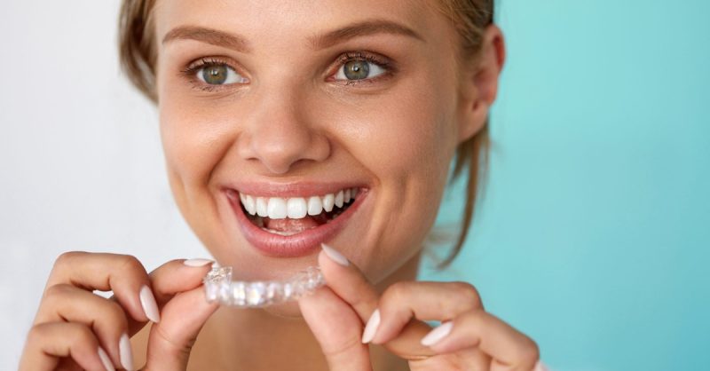 Home Teeth Whitening Kit with Custom Trays at Brighten Up Dental Clinic