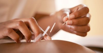 Acupuncture or Ear Candling at Be Health Chinese Medical Centre