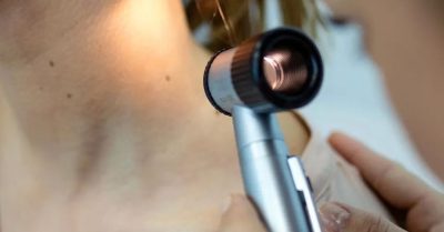 Electrolysis Skin Lesion Removal at Soft Soles Beauty And Aesthetics