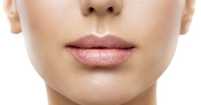 Lip Filler Enhancement with Consultation at Adrienn Varga Aesthetics