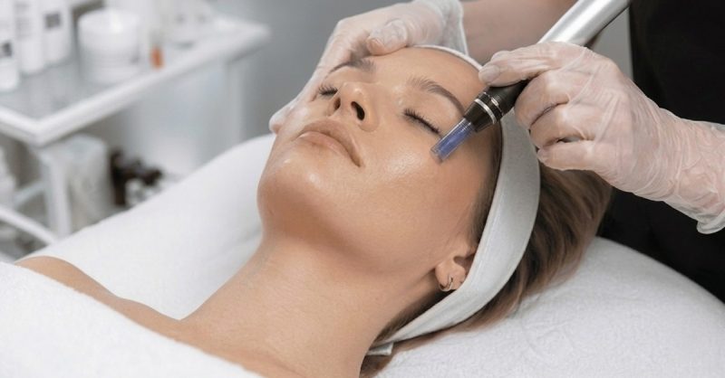 RF Microneedling Sessions at Ebru Gunduz Wellness for Smoother Skin