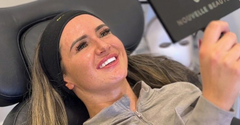 Revitalize Your Skin with Microneedling at Nouvelle Beaute