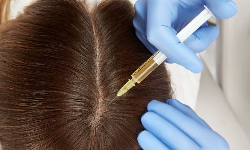 Doctor-led PRP Treatment for Hair Restoration at Maison De Skin