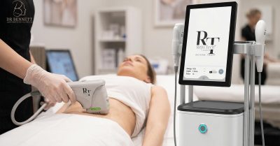 HIFU Facial Treatment for Full Face and Neck at Dr Bennett Aesthetics Clinics