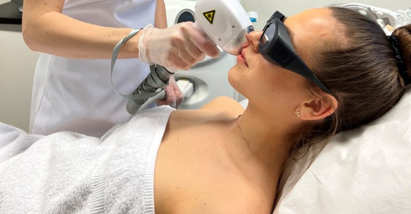 Laser Hair Removal at Moda Donna Beauty Clinic - Canary Wharf