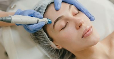 Revitalize Your Skin with Microneedling at Orchid Wellness Clinic