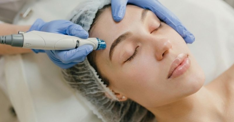 Revitalize Your Skin with Microneedling at Orchid Wellness Clinic