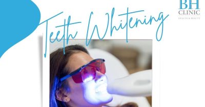 Laser Teeth Whitening Sessions at The BH Clinic for a Radiant Smile