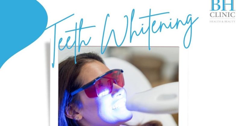 Laser Teeth Whitening Sessions at The BH Clinic for a Radiant Smile