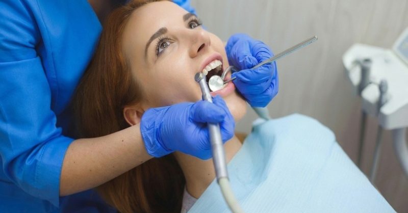 Composite Bonding for 2-8 Teeth at Wembley Orthodontic & Aesthetics