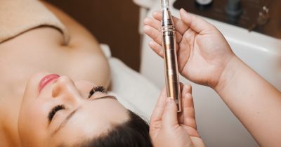 Revitalize Your Skin with Microneedling at The Aesthetics Lounge