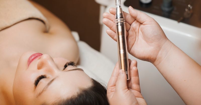 Revitalize Your Skin with Microneedling at The Aesthetics Lounge