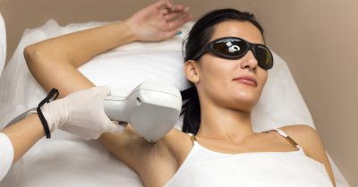 Six Laser Hair-Removal Sessions at Body Alchemist Aesthetics