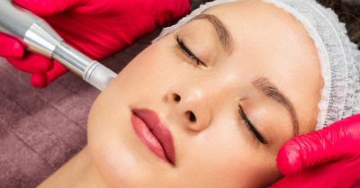 Revitalize Your Skin with Micro-Needling at Fida Aesthetic - Aesthetic Boutique