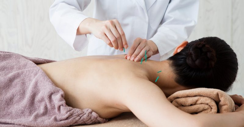 Revitalize with Acupuncture Services at Dr Hu Acupuncture Centre