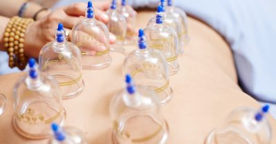 Revitalize with Cupping at Dr King herbal wellness