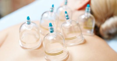 Cupping Sessions with Consultation at Physioderma clinic