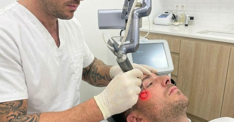 CO₂ Laser Skin Rejuvenation at Humman Skin for Youthful Skin