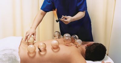 Cupping Therapy at MA Health and Wellbeing Centre in South Shields