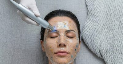 Revitalize Your Skin with Facial Treatments at Aesthetic By Nurse
