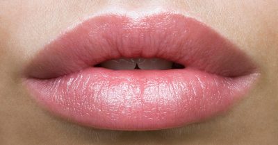 Dermal Fillers for Lip, Chin or Cheek at London Aesthetic Clinic