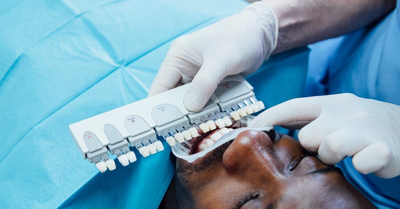 Custom Home Teeth Whitening Kit at Sonria Dental Clinic