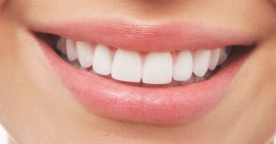 Titanium Dental Implant with Porcelain Crown at All Saints Dental Clinic
