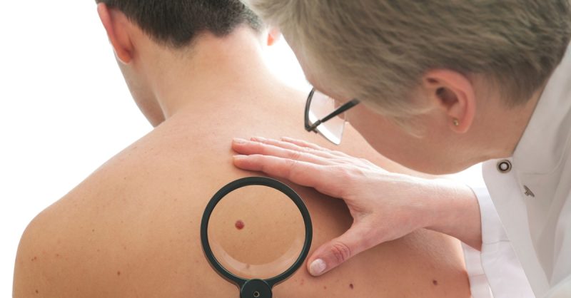Achieve Flawless Skin with Aesthetic Zone's Blemish Treatment